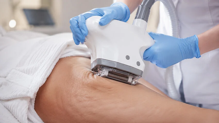 VelaShape от целлюлита: помогает ли процедура и на каких стадиях ждать эффект